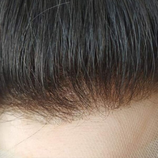 fine hair patch